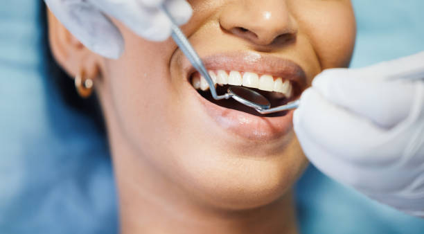 Best Walk-In Emergency Dentist in Pleasant Grove, UT